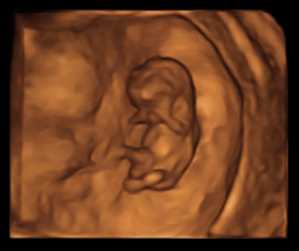 embrio (002)