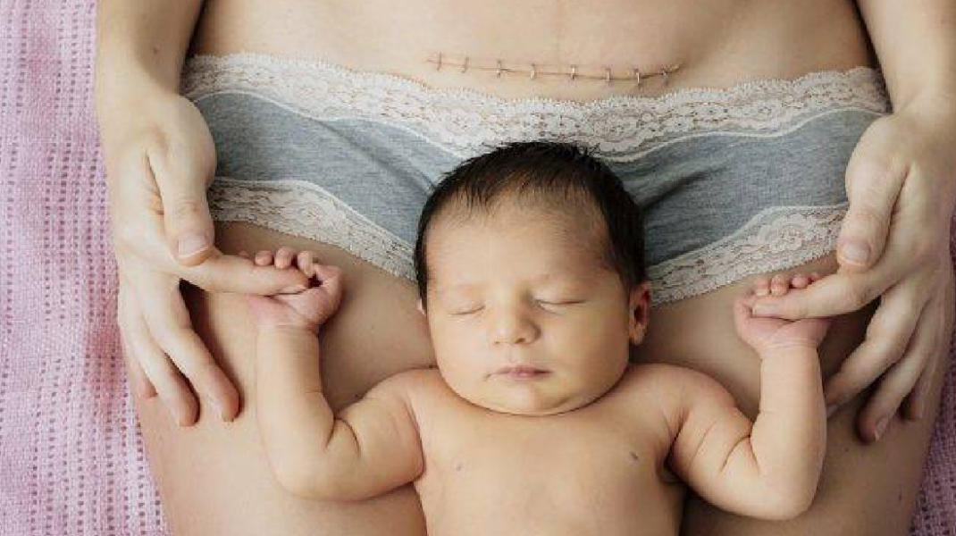 Márki-Zay Péter szerint a szüléshez nem kell orvos